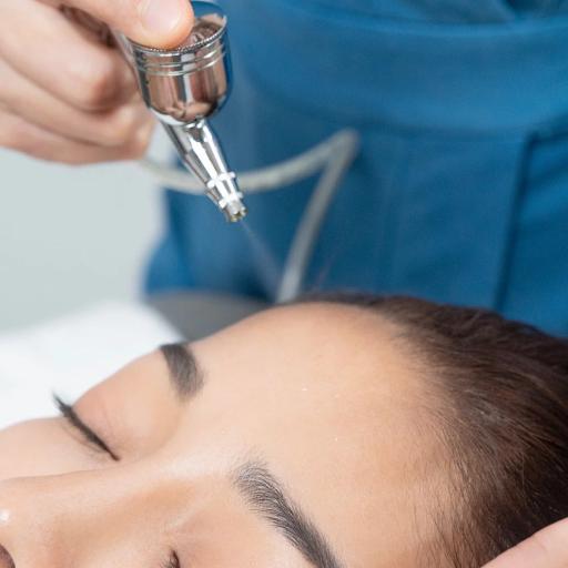Oxyjet Clear Facial w/ Diamond Peel