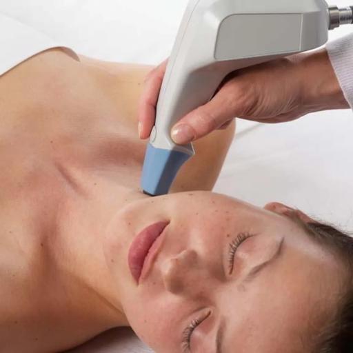 Exilis Ultra (Face)